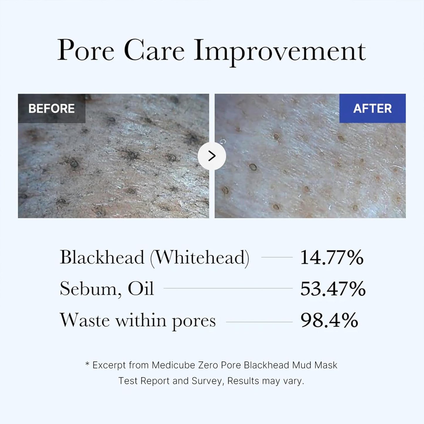 Medicube - Zero Pore Blackhead Mud Mask (100g)
