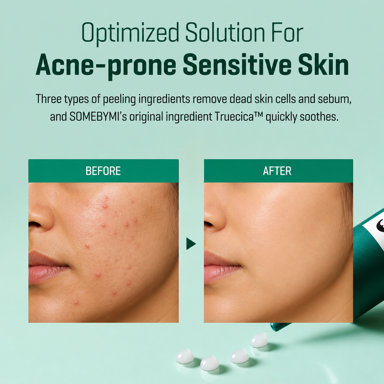 SOME BY MI AHA BHA PHA 14 Days Super Miracle Spot Cream 30ml