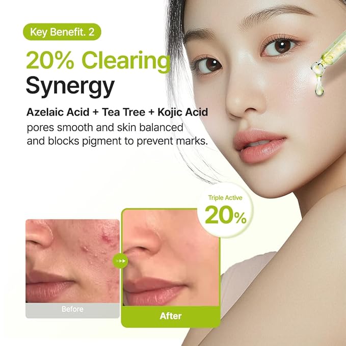 Purito Seoul - Azelaic Acid 10 Kojic Tea Tree Serum (30ml)