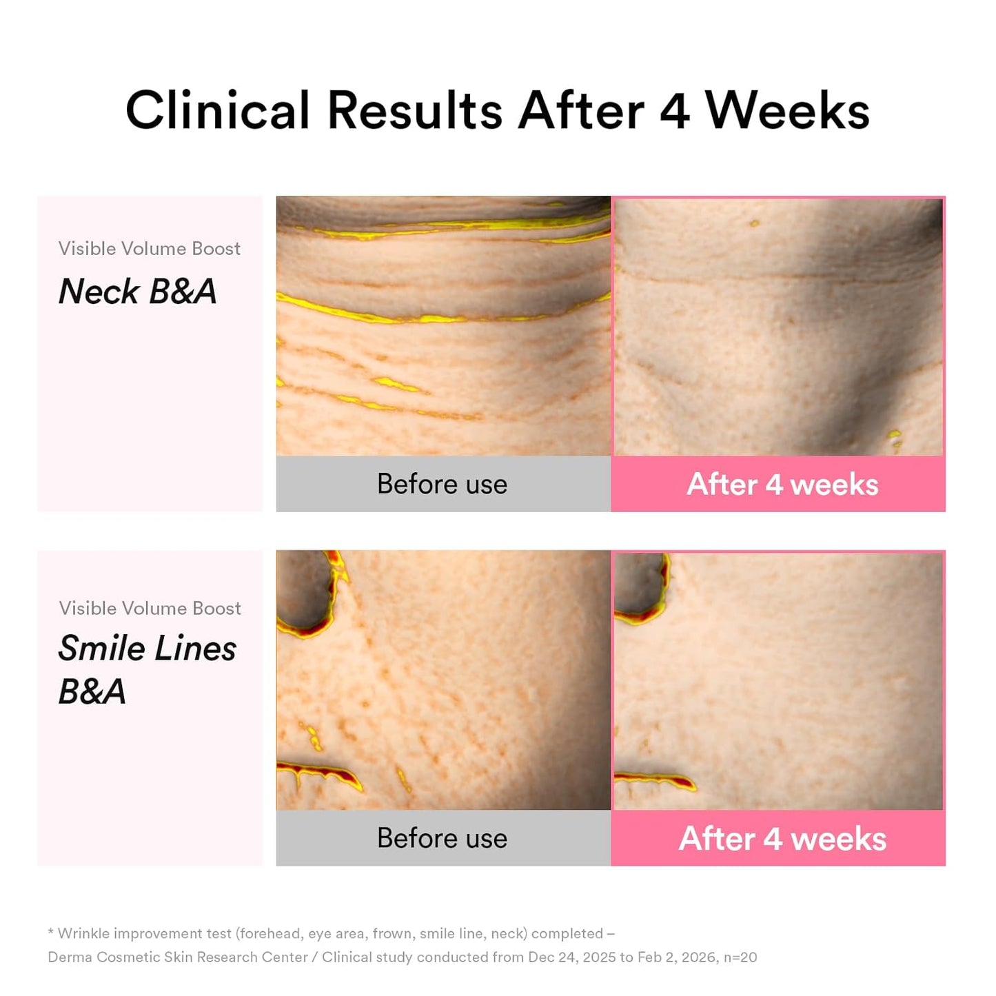 Abib - PDRN Volume fill-it (30ml)