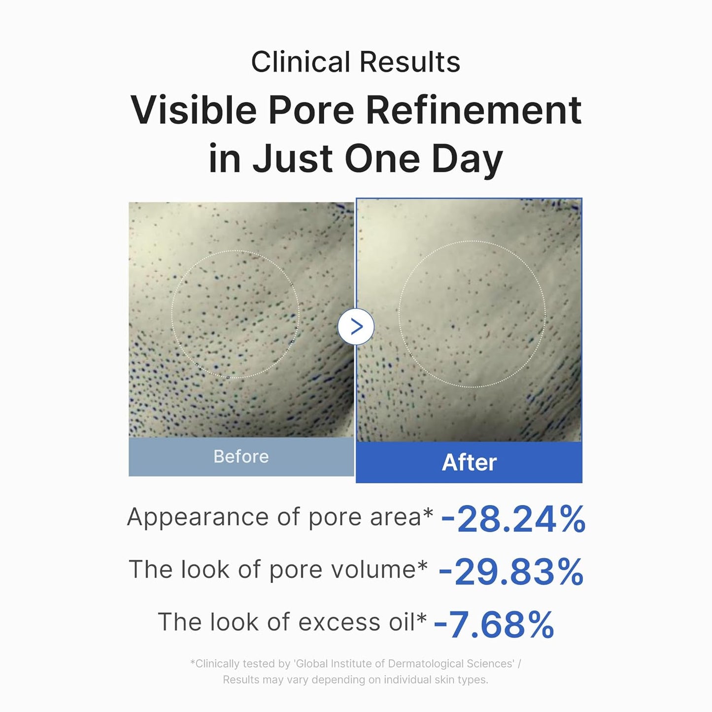 ✨ Pore Control