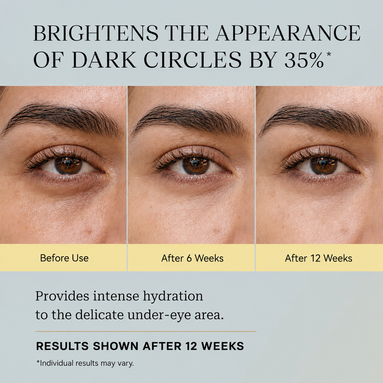 ✨ Bye Bye Dark Circles