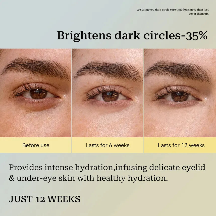 Adiós Ojeras