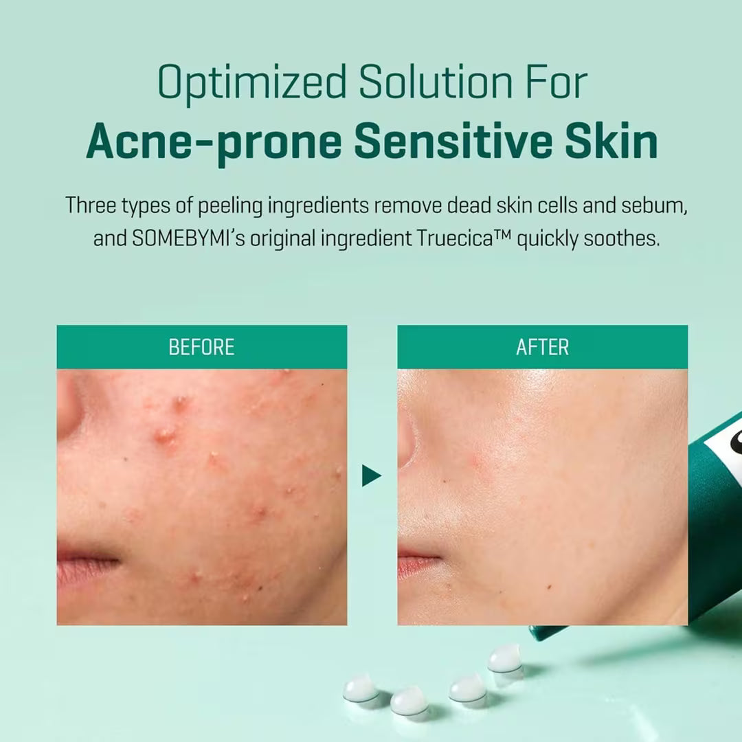 SOME BY MI AHA BHA PHA 14 Days Super Miracle Spot Cream 30ml