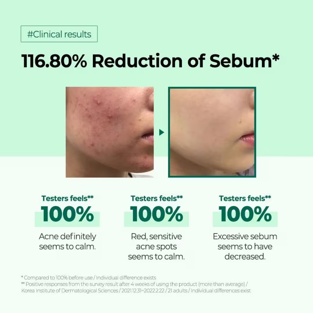 SOME BY MI AHA BHA PHA 30 Days Miracle Toner 150ml